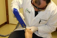 Laser Nail Fungus Treatment