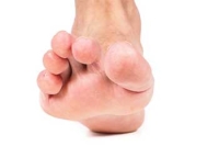Treating Harmful Hammertoes