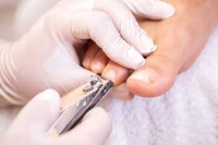 Don’t Ignore the Ouch! Unpleasant Consequences and Untreated Toenails